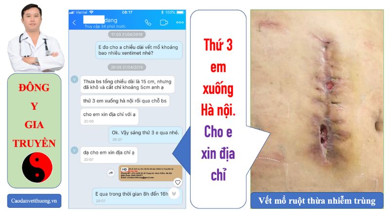 Bài giảng chăm sóc vết thương