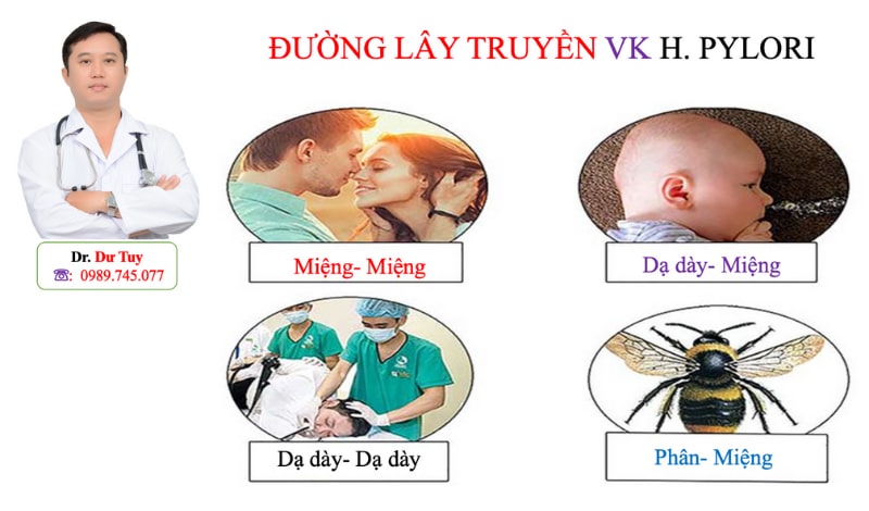 Bài thuốc chữa viêm dạ dày