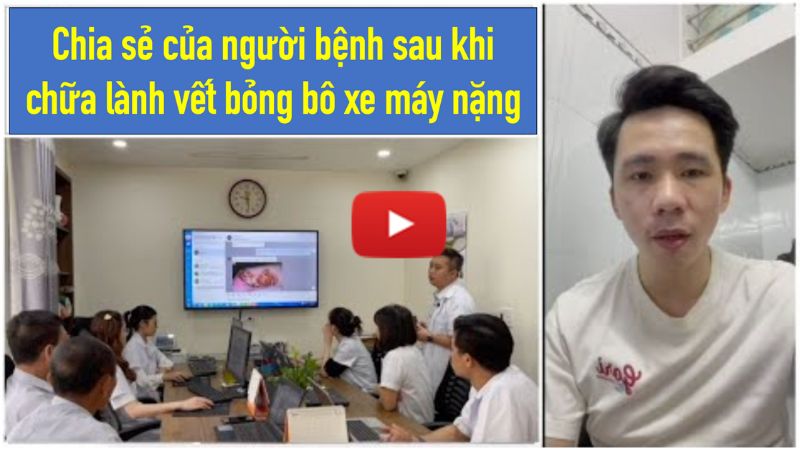 Bỏng bô xe máy nặng