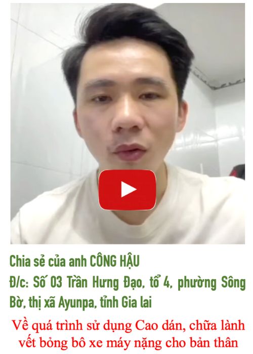 Chữa lành bỏng bô xe máy nặng