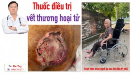 Bs Tuy thăm bệnh nhân 87 tuổi bị nhiều vị trí lở loét trên cơ thể được điều trị khỏi bằng Cao dán gia truyền