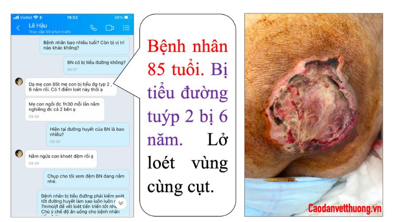 Chữa loét da người già