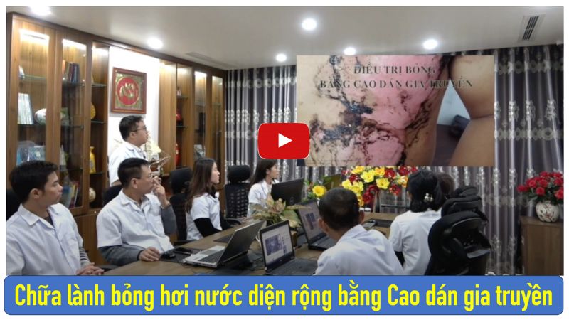 Cách chữa bỏng