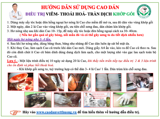 Phác đồ điều trị tràn dịch khớp gối