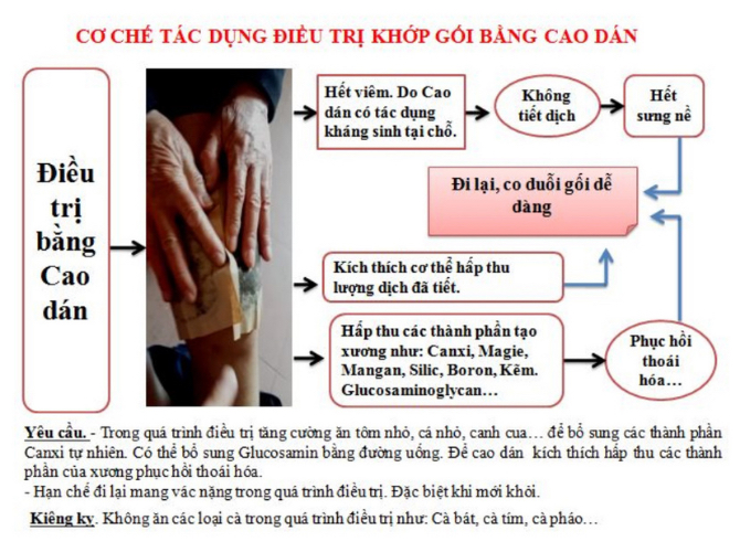 Thuốc điều trị đau khớp gối