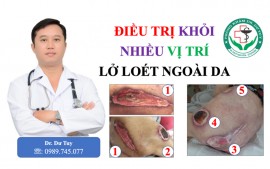 Cách nhận biết vị trí và đánh giá mức độ loét da tì đè