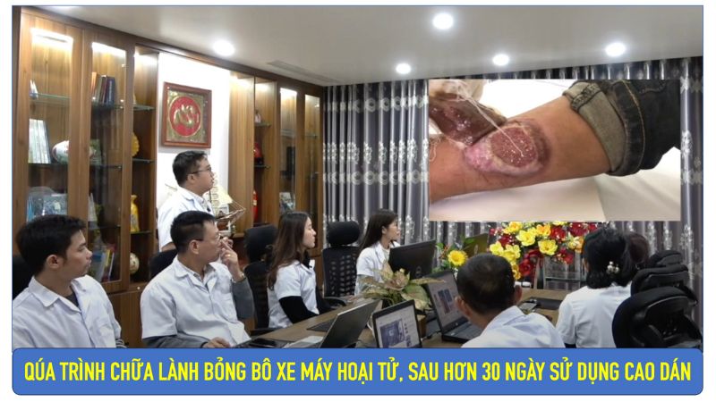 Hành trình chữa lành vết bỏng xe máy bô hoại tử