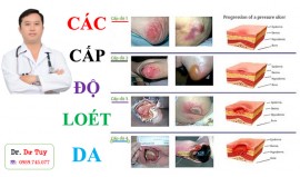 Cấp độ loét da tì đè