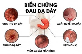 Chữa đau dạ dày bằng thuốc Đông y