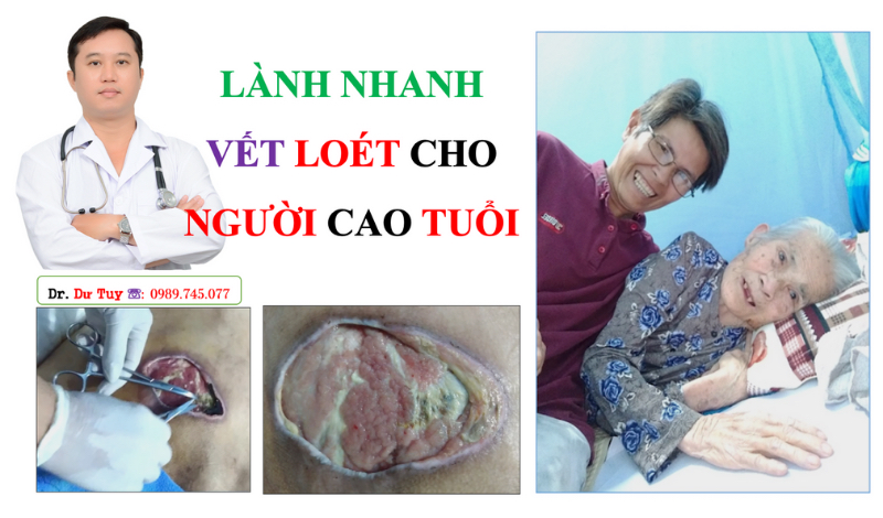 Chữa loét da người già