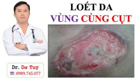 Chữa loét tì đè cho bệnh nhân nằm liệt