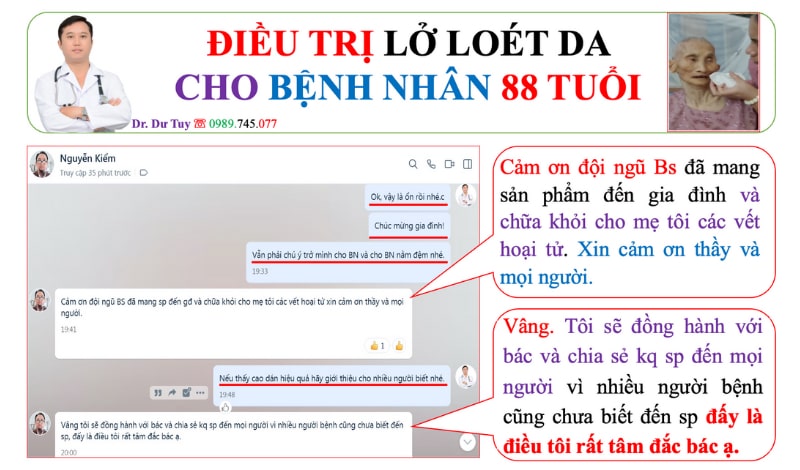 Lở loét da vùng xương cụt