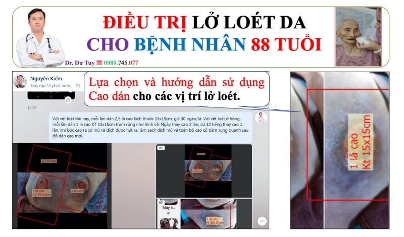 Loét da ở người già