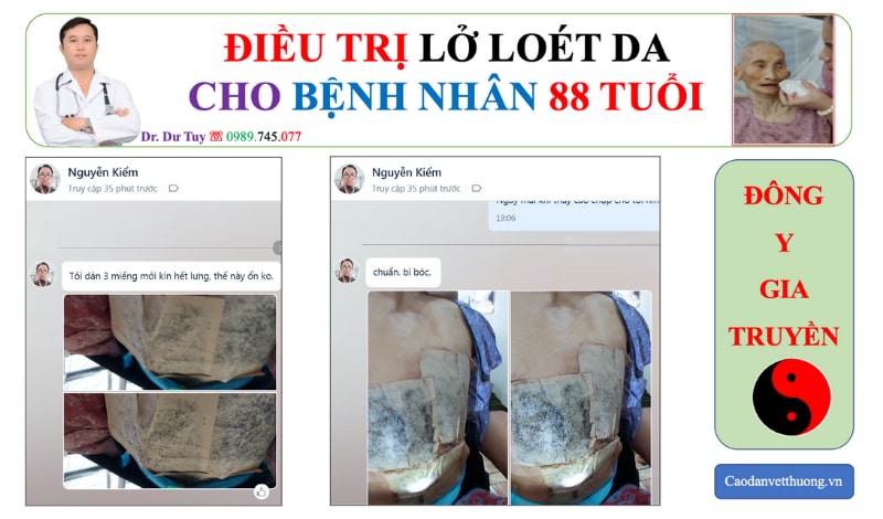 Loét da ở người già