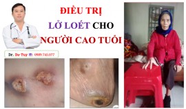  Tìm cách chữa loét da tì đè cho người già