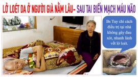 Lở loét da ở người già nằm lâu sau tai biến mạch máu não