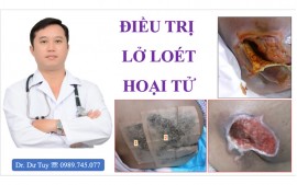 Lở loét da ở người già nằm lâu