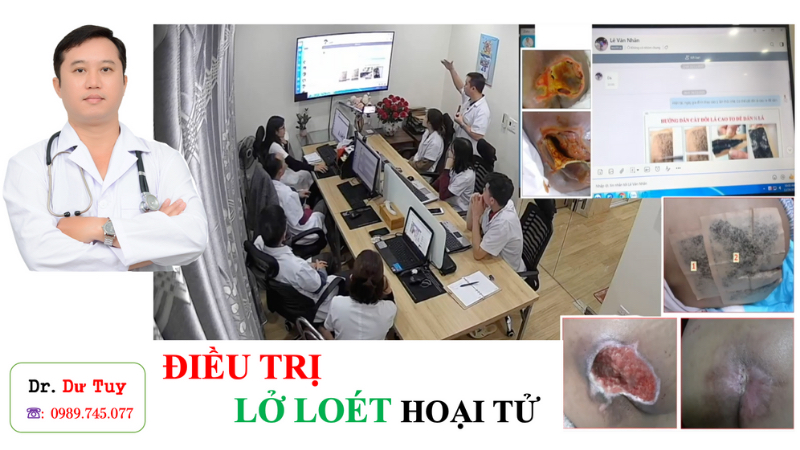 Miếng dán trị lở loét hoại tử