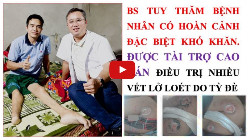 Lở loét vùng cùng cụt do tổn thương tuỷ sống