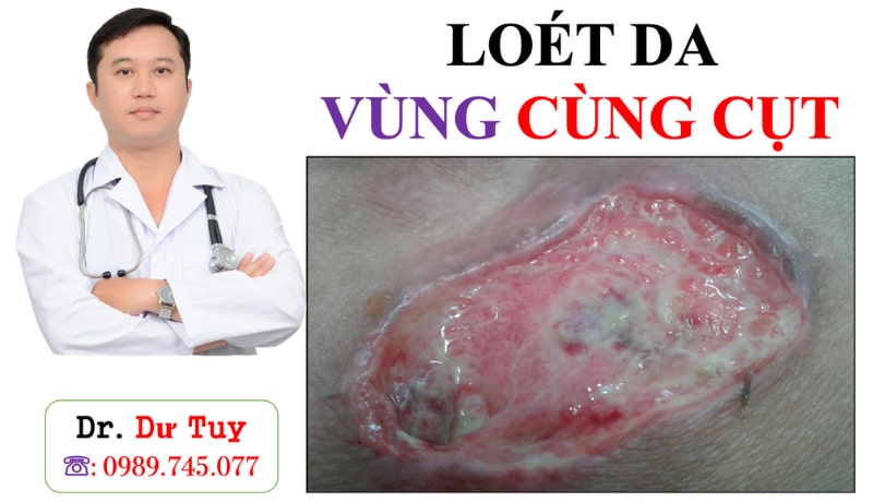 loet-da-vung-cung-cut-do-nam-bat-dong-lau-ngay