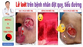 Loét tì đè ở bệnh nhân tiểu đường