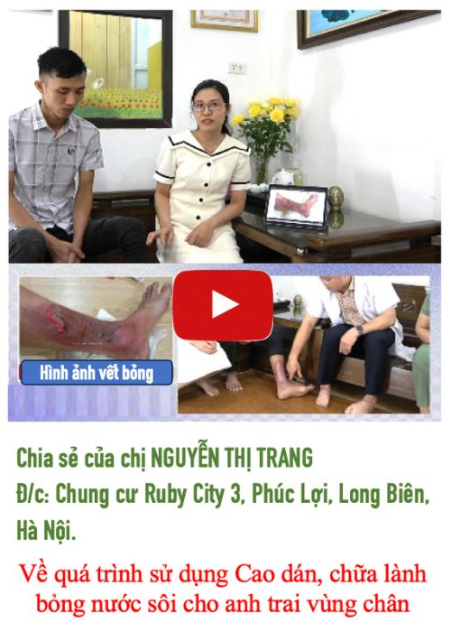 Cách trị bỏng