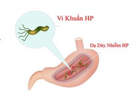 Nhiễm vi khuẩn Hp dạ dày có sử dụng thuốc Đông y được không