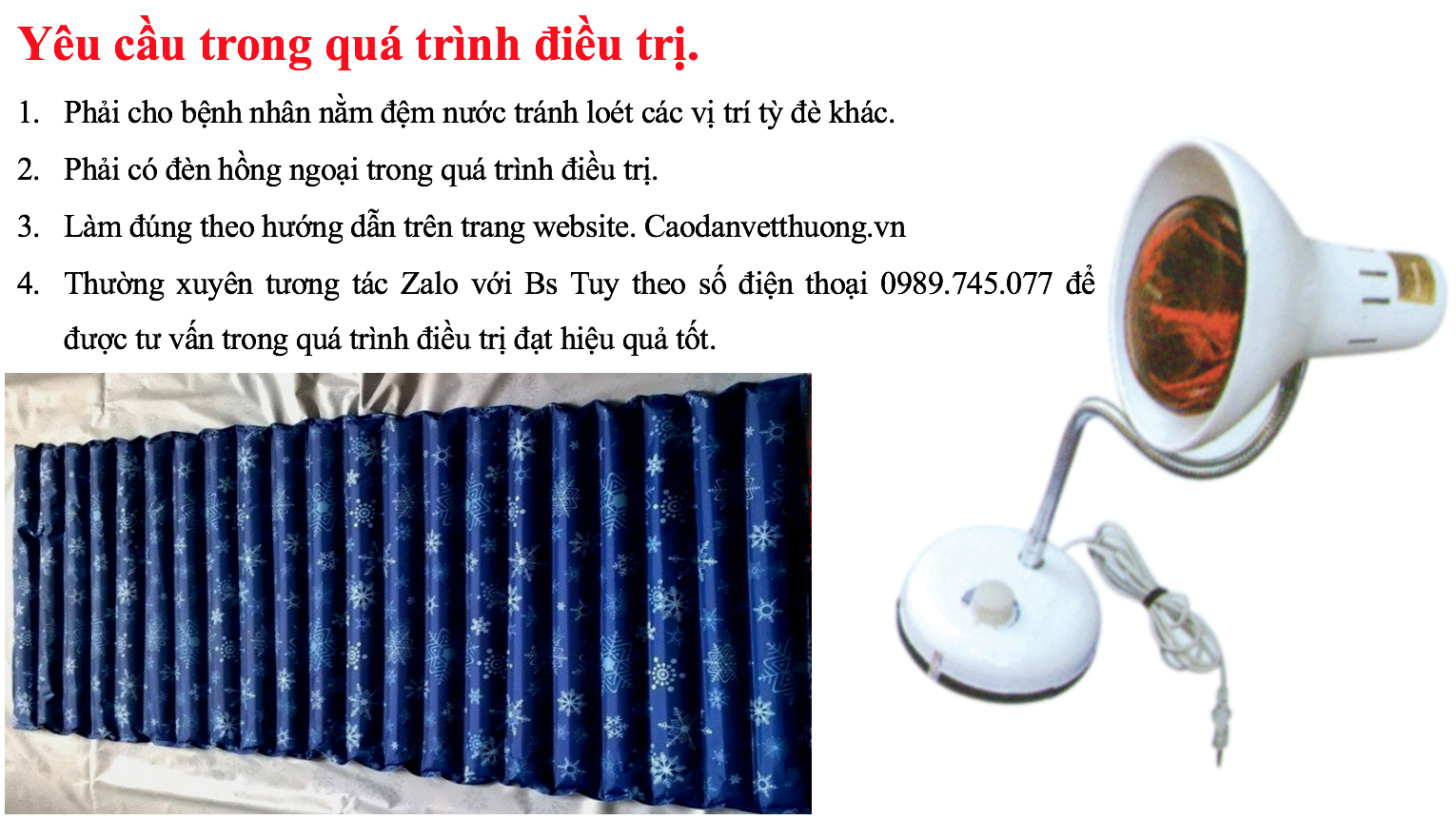 Điều trị vết loét