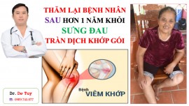 ĐIỀU TRỊ SƯNG ĐAU TRÀN DỊCH KHỚP GỐI TẠI NHÀ