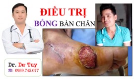 ĐIỀU TRỊ BỎNG BÀN CHÂN