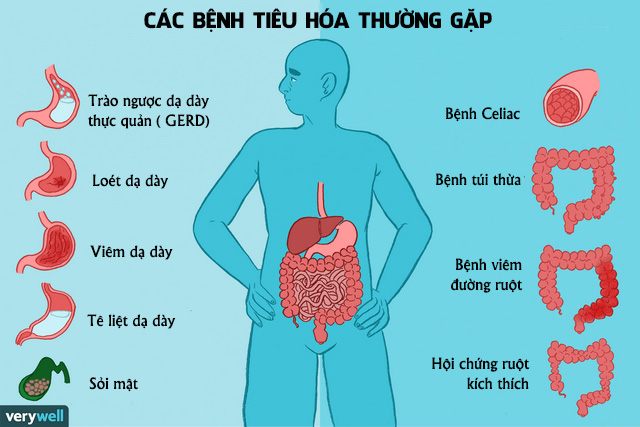 thuoc-dieu-tri-da-day-dai-trang-an-toan-hieu-qua-tai-hai-duong