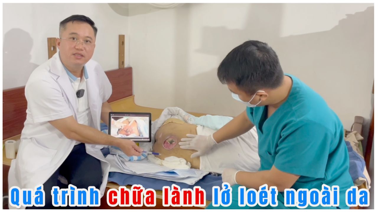 Quá trình chữa lành lở loét da cho người bệnh ở Gia Lâm- Hà Nội