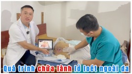 Tư vấn điều trị loét da dưới sự hướng dẫn của bác sỹ Tuy