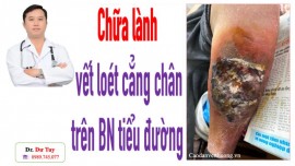 Vết thương khó lành ở chân người tiểu đường