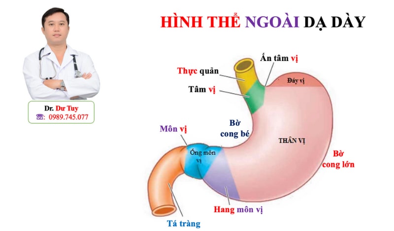 Viêm loét dạ dày nặng